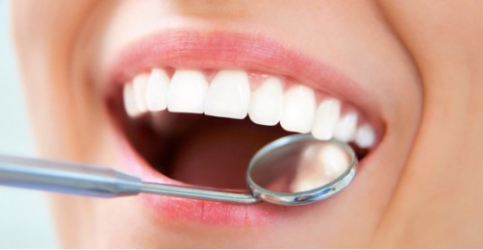 ¿Los Implantes dentales son para siempre?